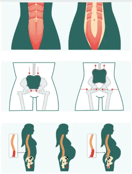 產後紮肚治療​